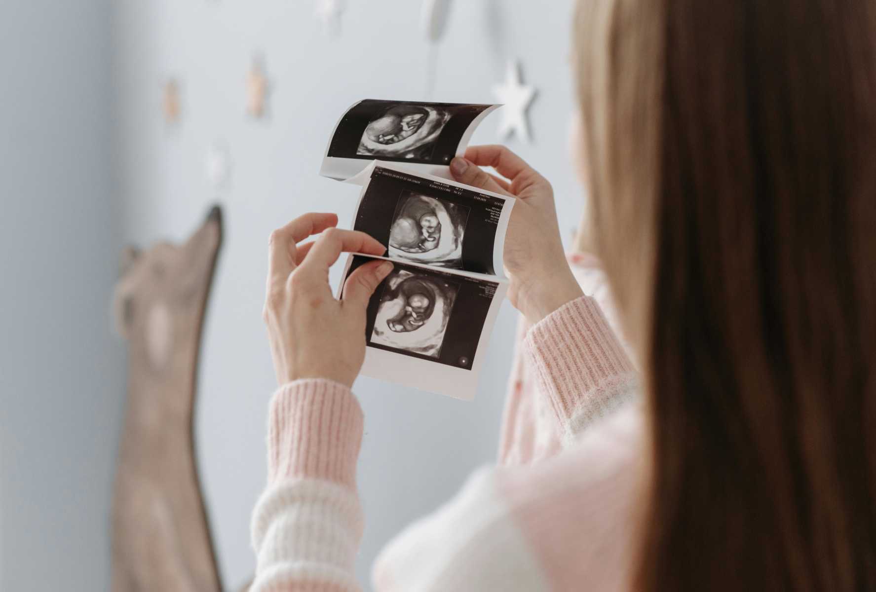 Sonografické vyšetrenia počas tehotenstva